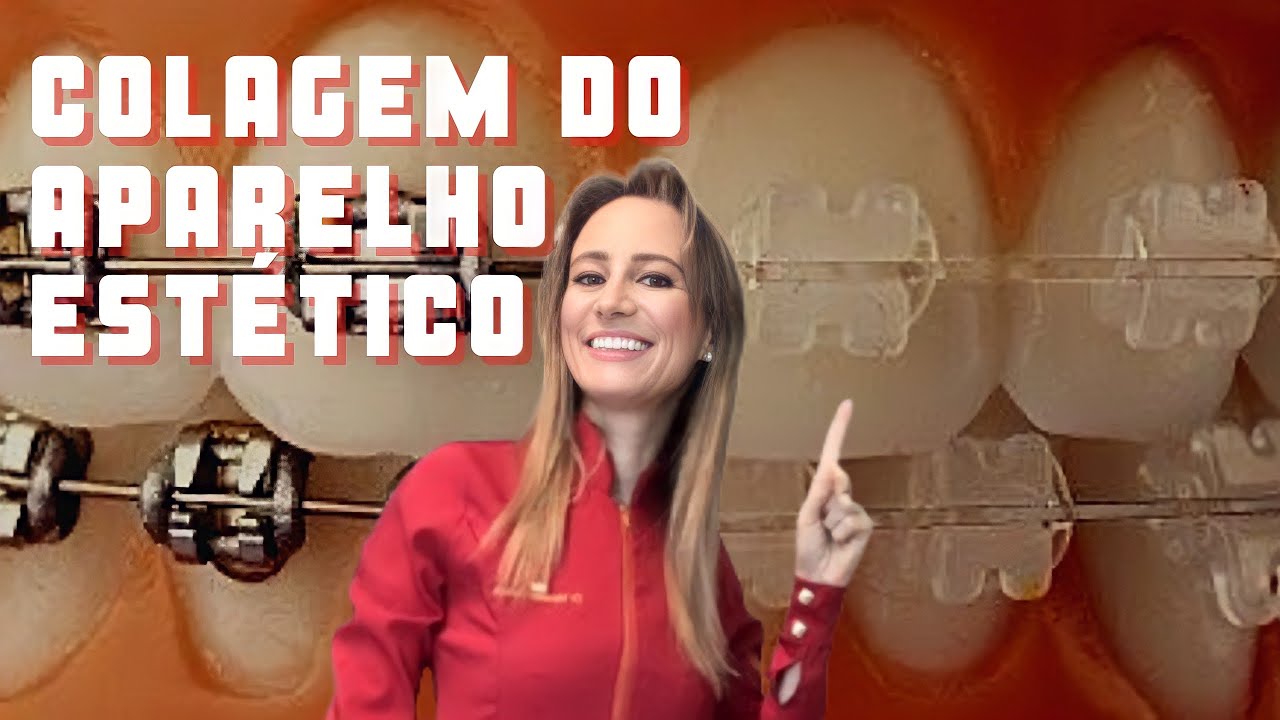 Como é a colagem do aparelho estético safira
