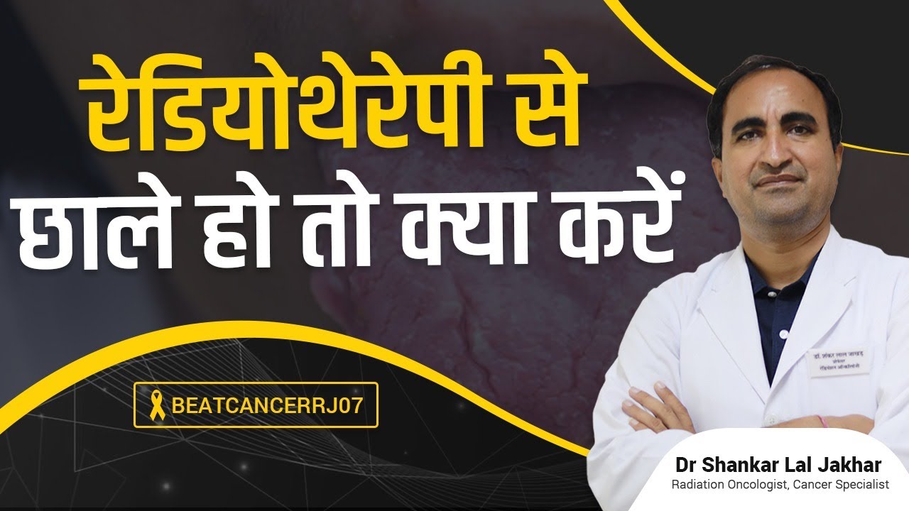रेडीयोथैरेपी से होने वाले छालों को कैसे रोके (how to prevent mucositis of radiotherapy)