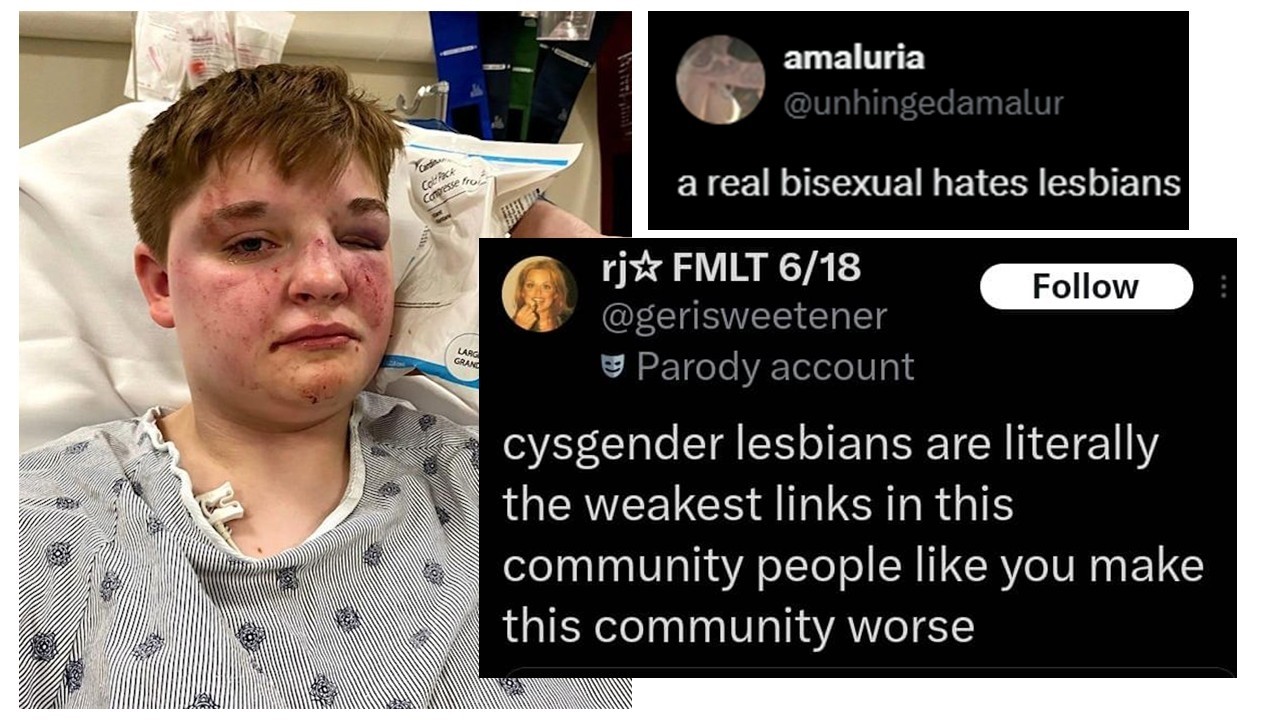 Лесбофобия в сообществе ЛГБТК+