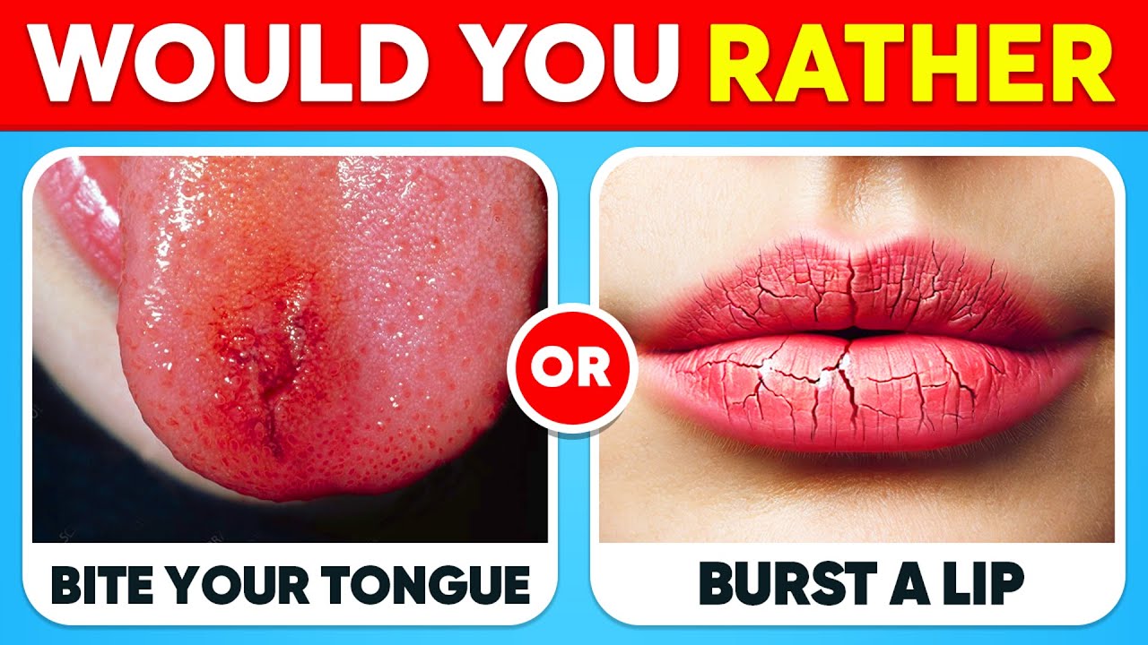 Would You Rather...? EXTREME Edition 😱⚠️ HARDEST Choices Ever! | Tom Quiz