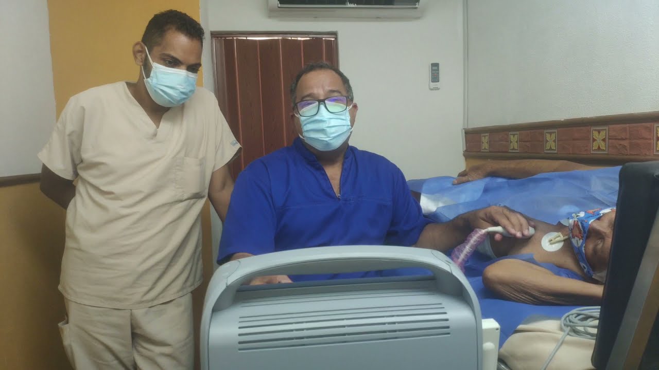 Cómo medirá la Fracción de Eyección en Ecocardiograma