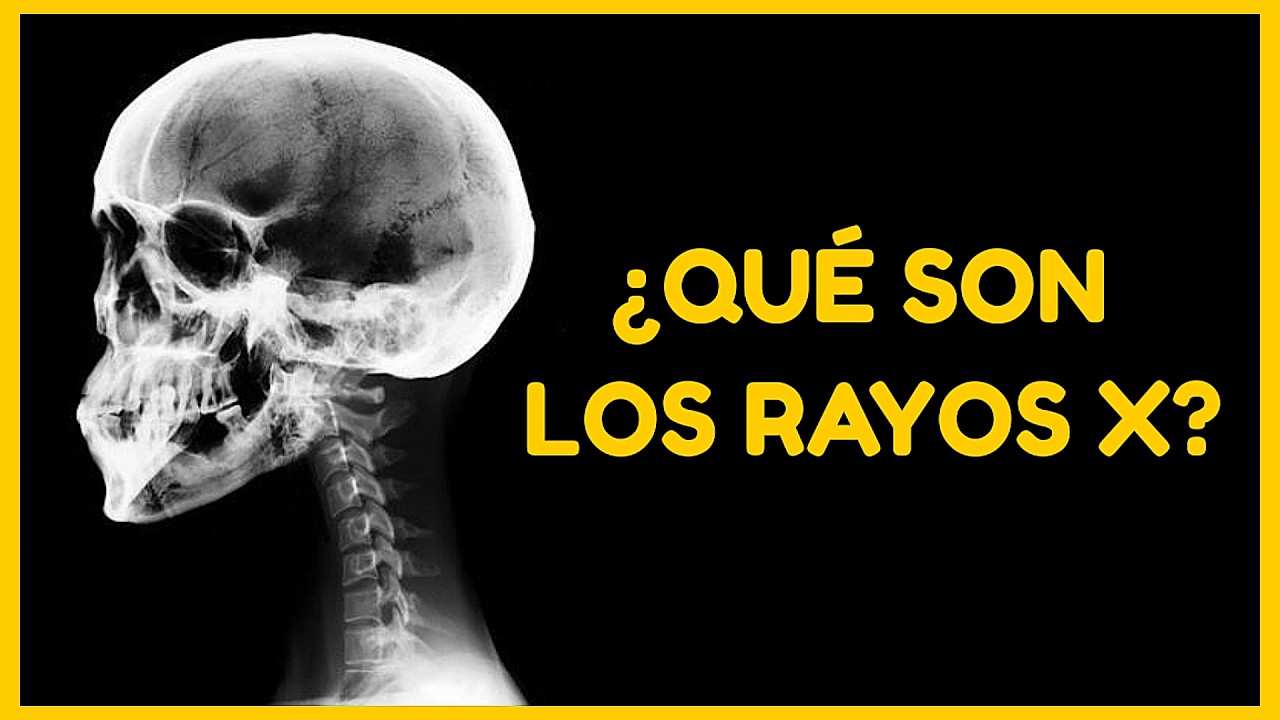 ¿Qué son LOS RAYOS X? ⚡ (MANUAL DE RADIOLOGÍA) #4