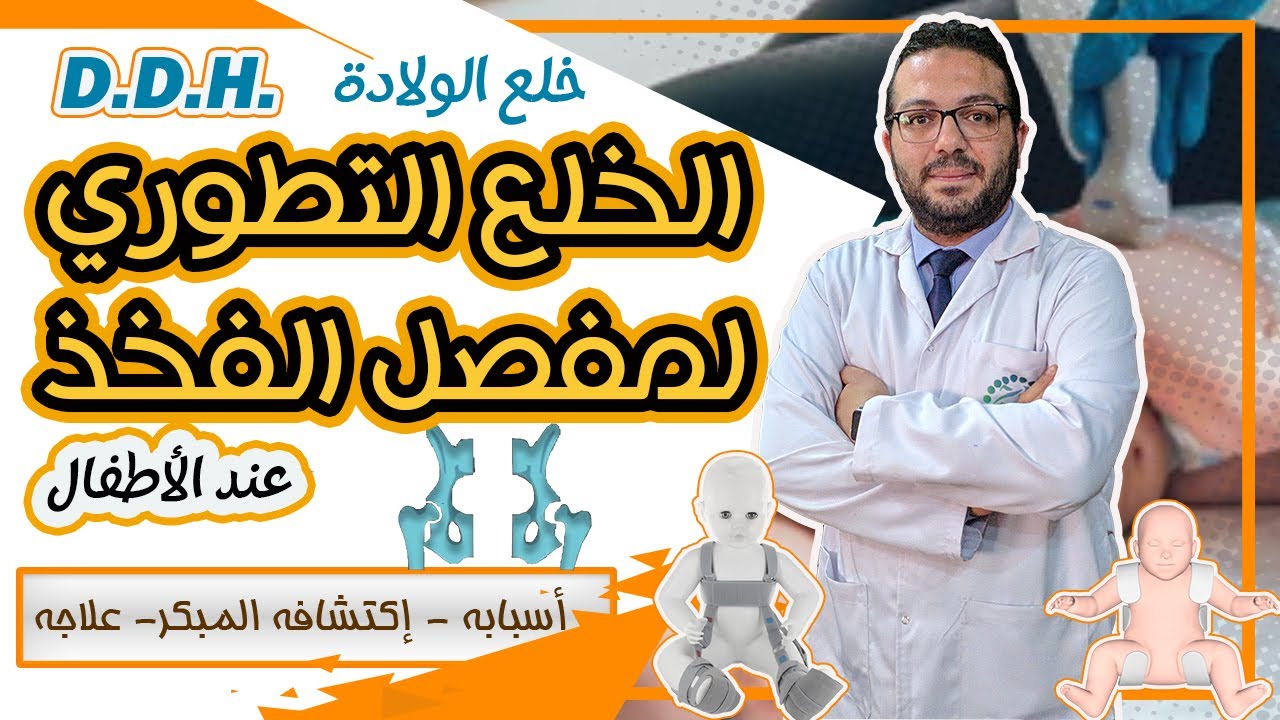 علاج خلع مفصل الفخذ التطوري [ الولادي ] عند الأطفال | وكيف تكتشفه الأم بنفسها مبكرا | حلقة كاملة