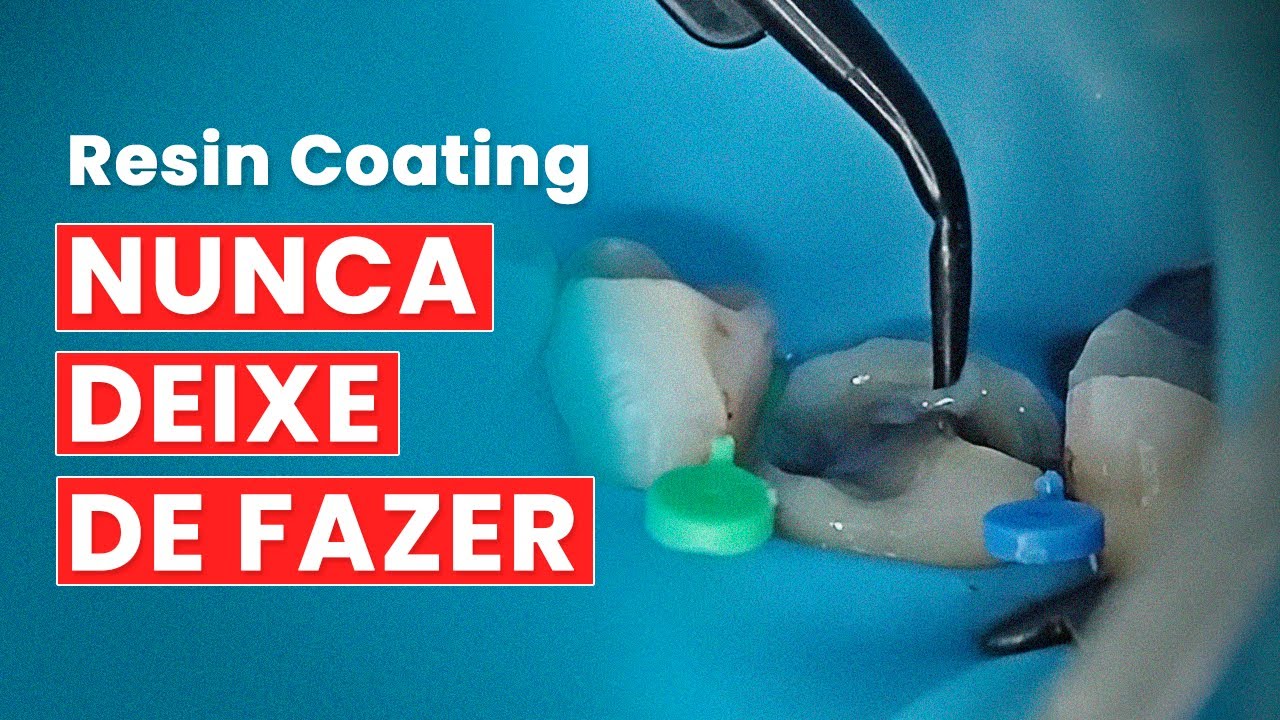 RESIN COATING - Mylene e Renato