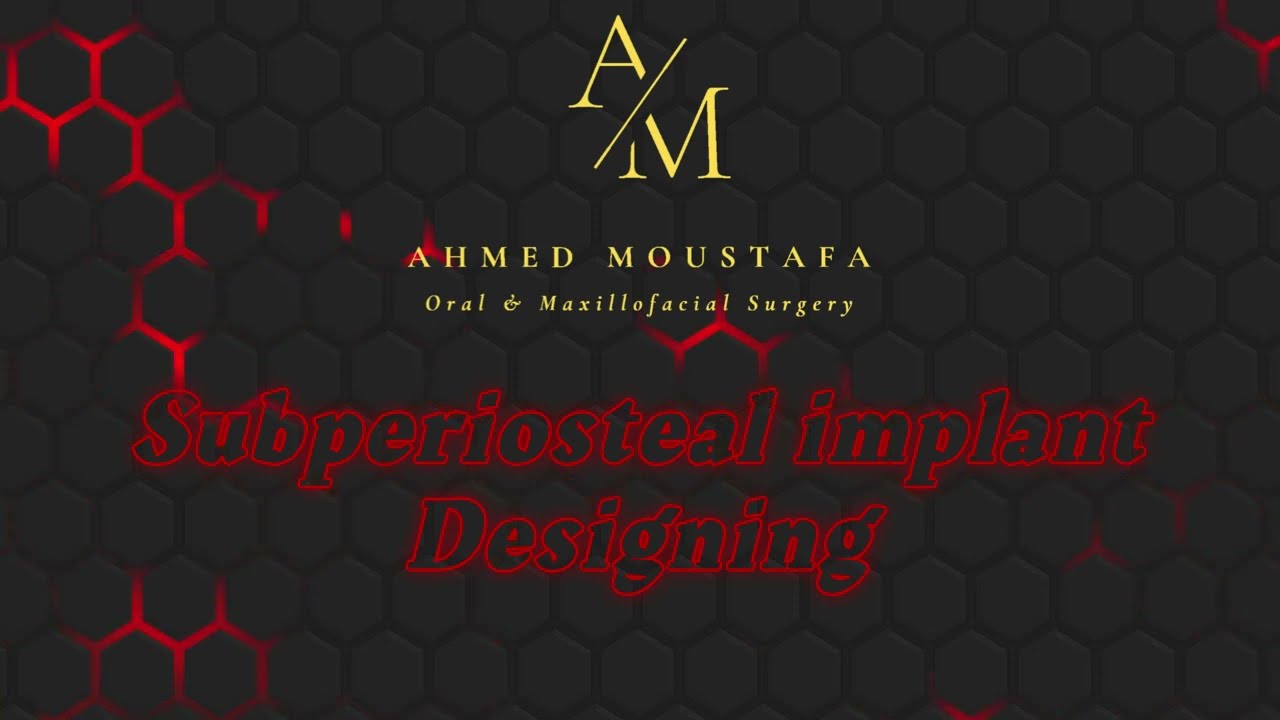 B4D: Subperiosteal implant designing