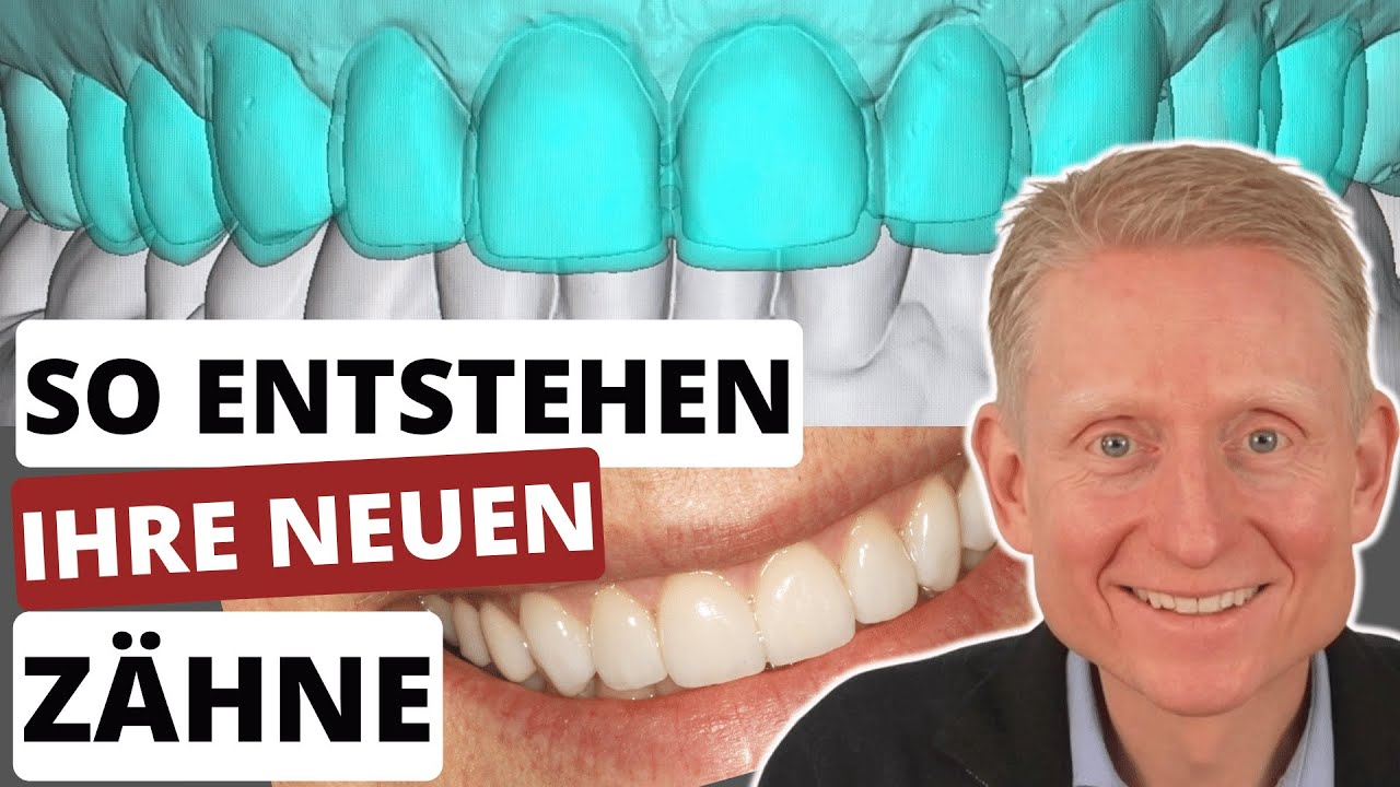 Weiße Zähne mit Veneers: Vorher - Nachher