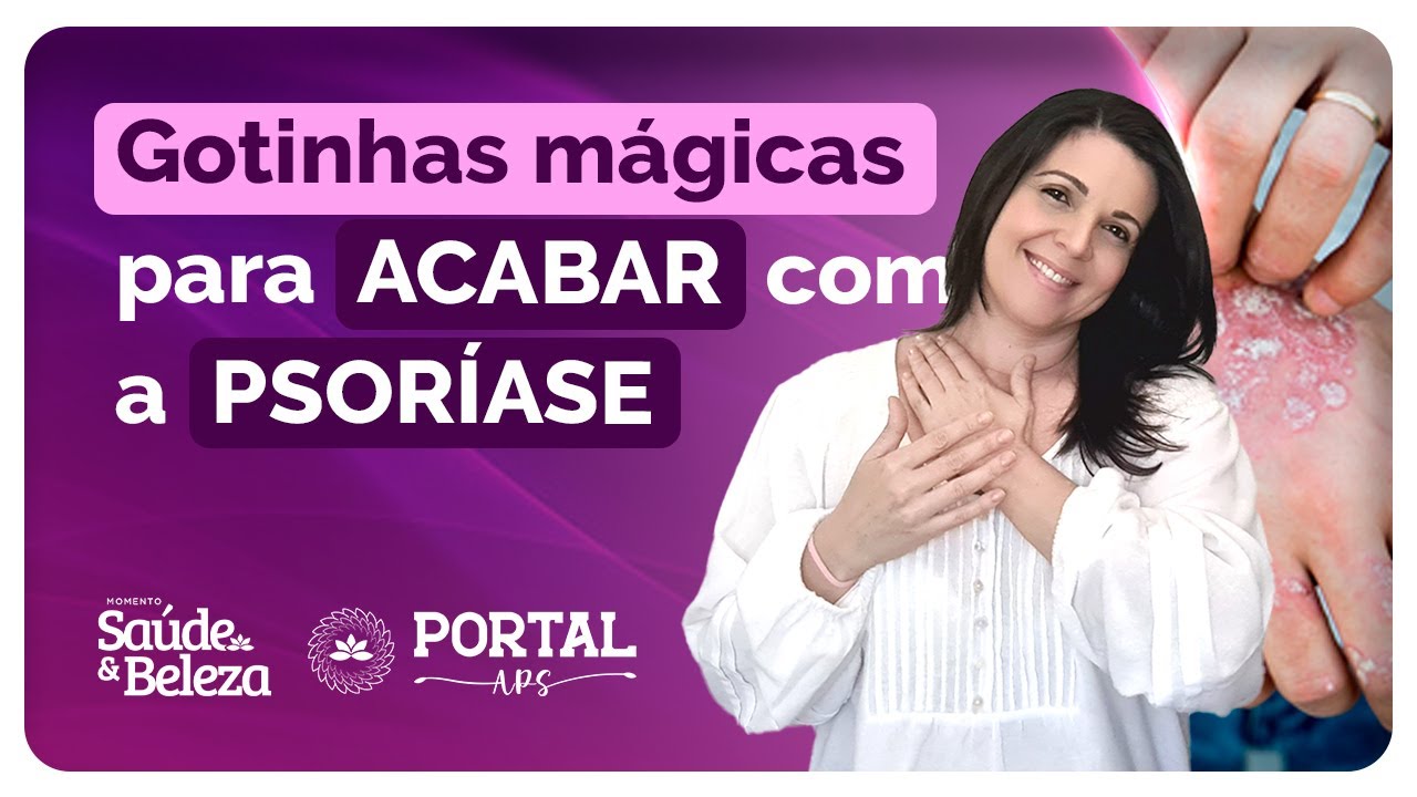Nunca mais sofra com PSORÍASE na sua pele (tratamento natural) | Momento Beleza e Saúde