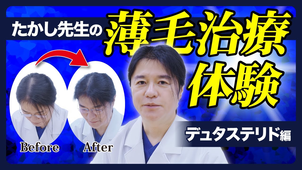 【薄毛】意外な効果や副作用を徹底解説！！実際に医師が薄毛治療を体験してみた！【デュタステリド編】