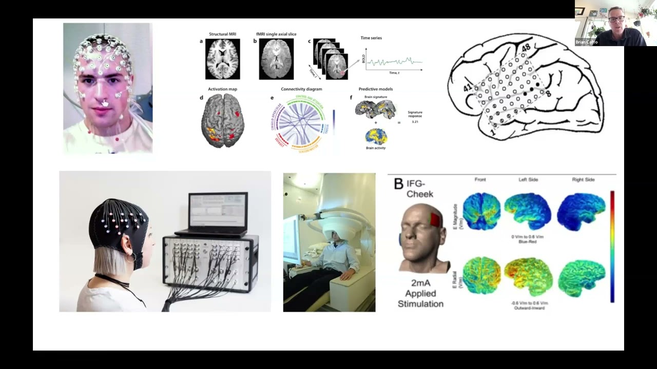 Statistical and AI Methods for Health Data Science Seminar -- Organoid Intelligence