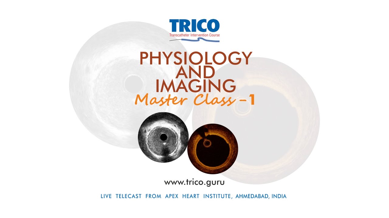 PCI to LAD using IVL under OCT/ IVUS guidance done by Tejas Patel and Sanjay Shah