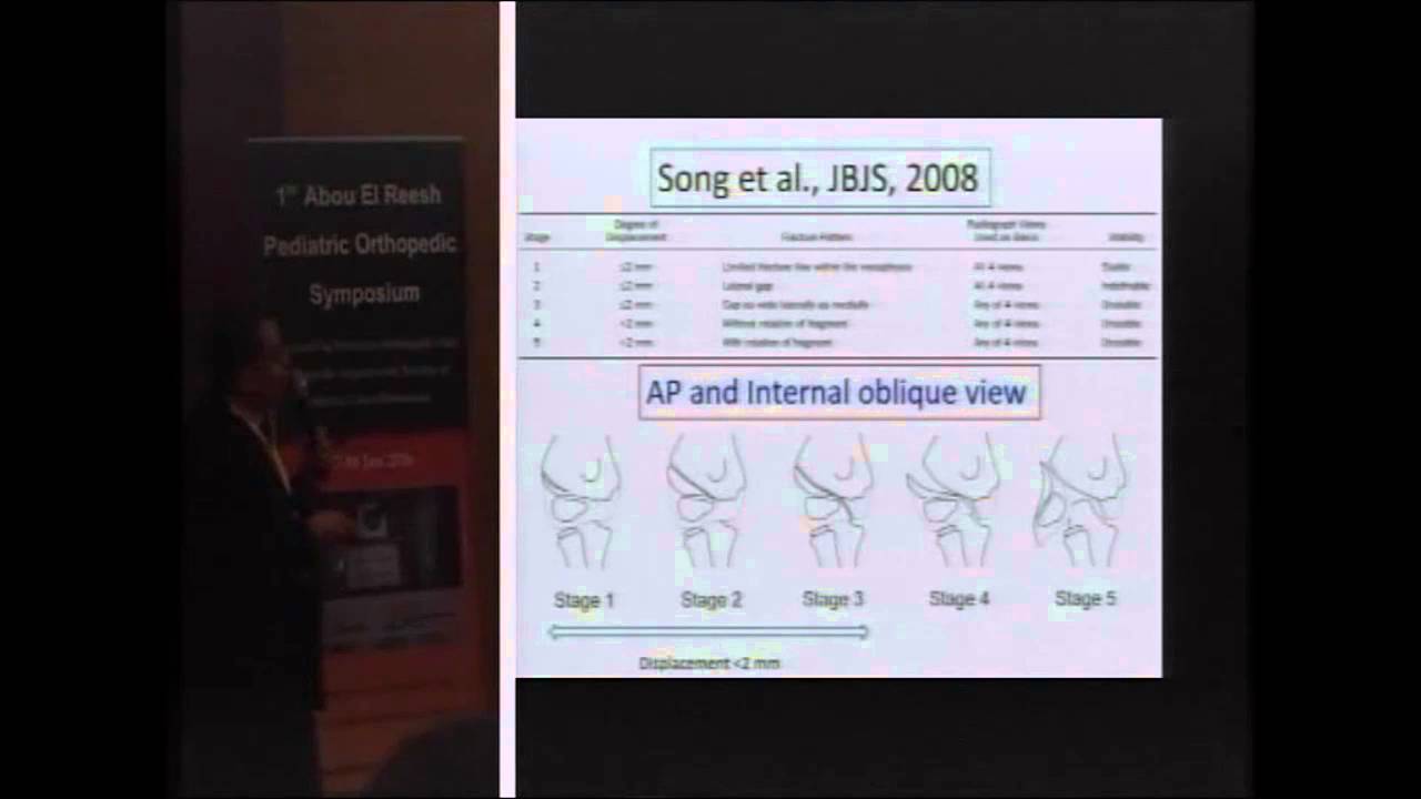 Fracture lateral condyle humerus