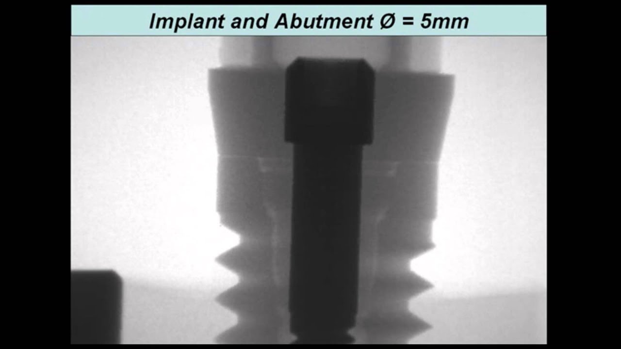 Zipprich   Micro Movements on Implant Abutment Interfaces part 1