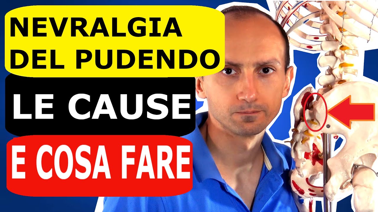 Nevralgia del Pudendo: le Cause e Cosa Fare