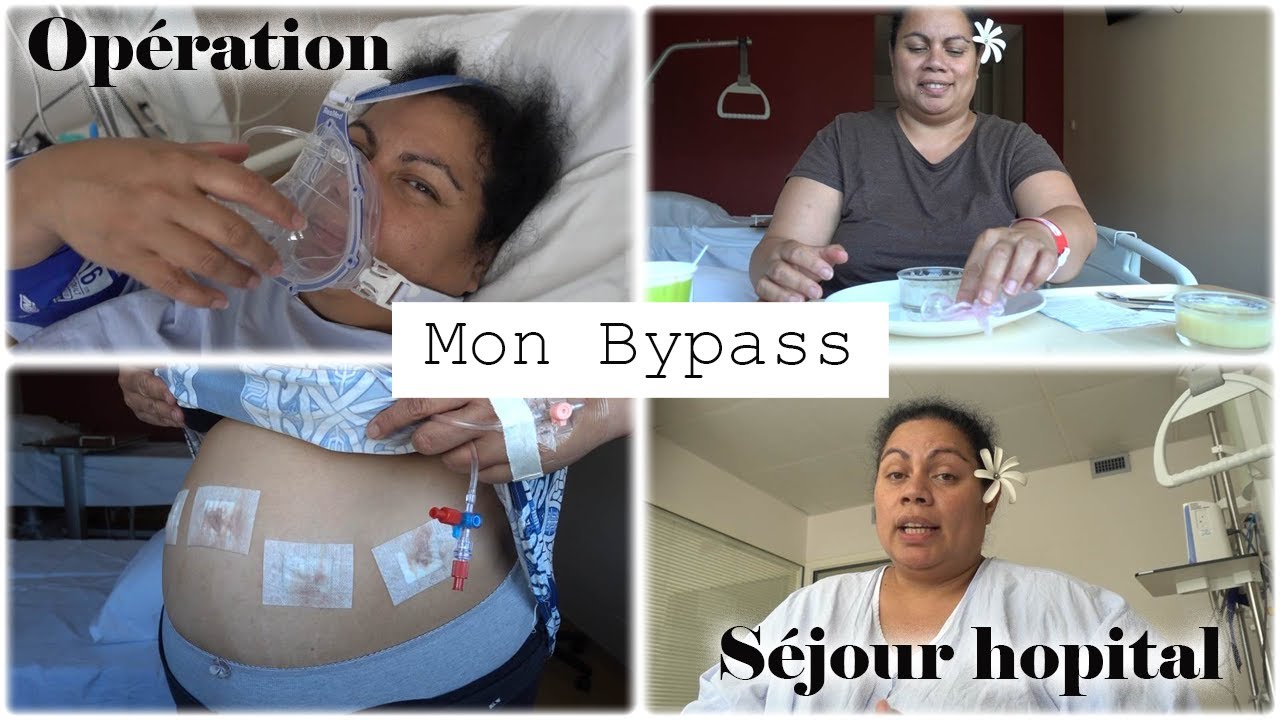 Mon Bypass : Opération , Séjour a l’hôpital, je vous dis tout
