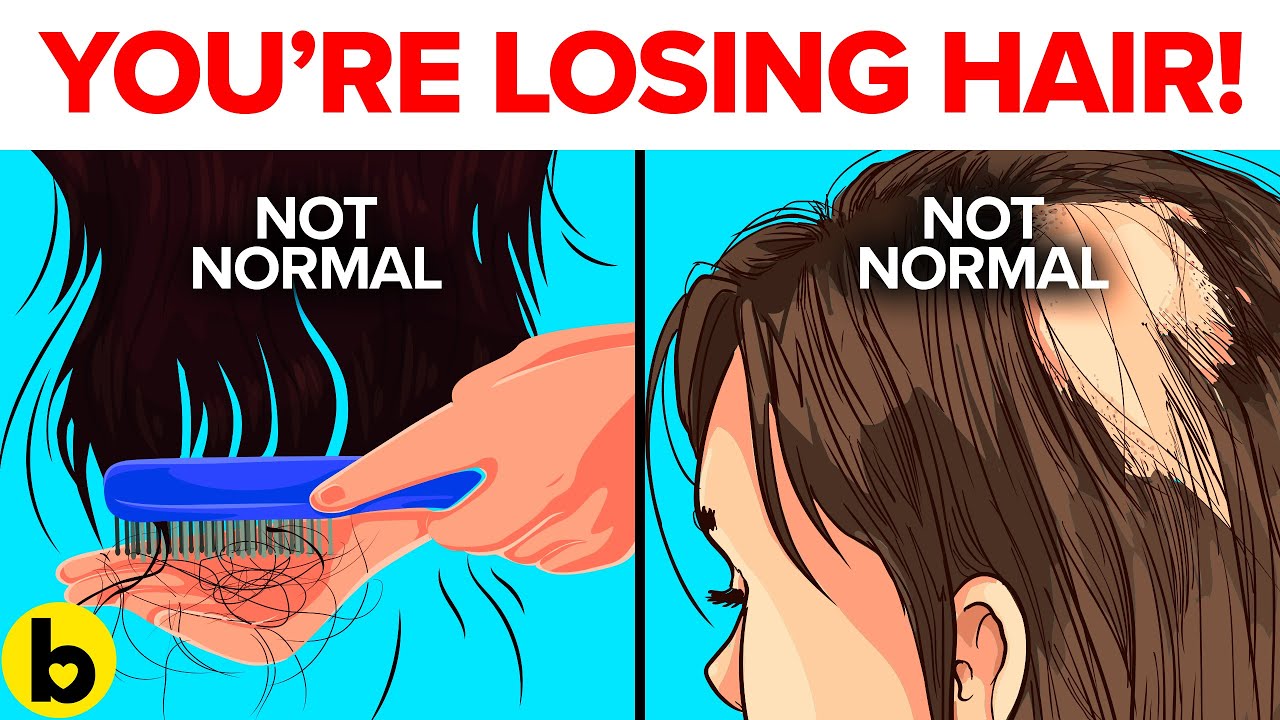 7 Ways To Tell If You're Losing Too Much Hair