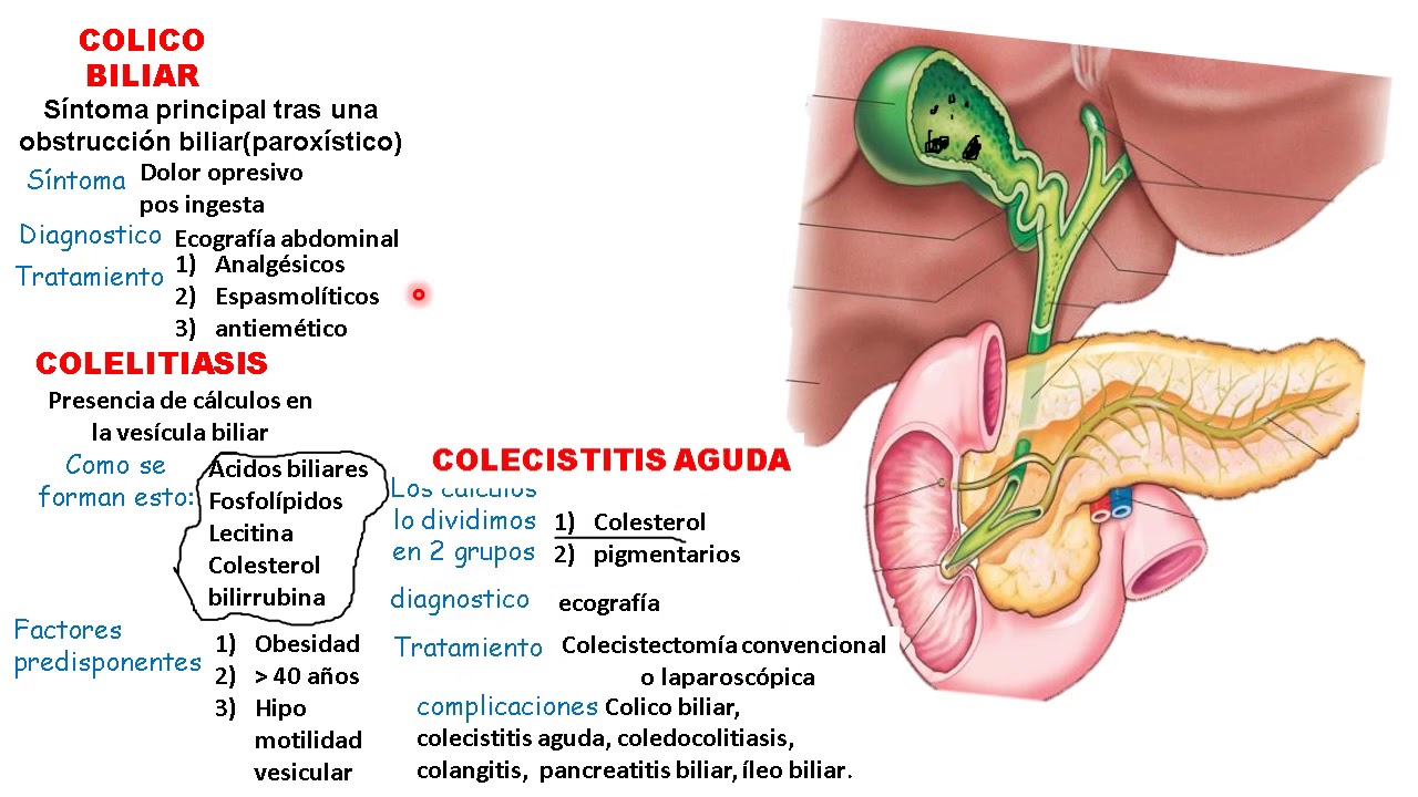 COLELITIASIS, COLECISTITIS, COLEDOCOLITIASIS, COLANGITIS.