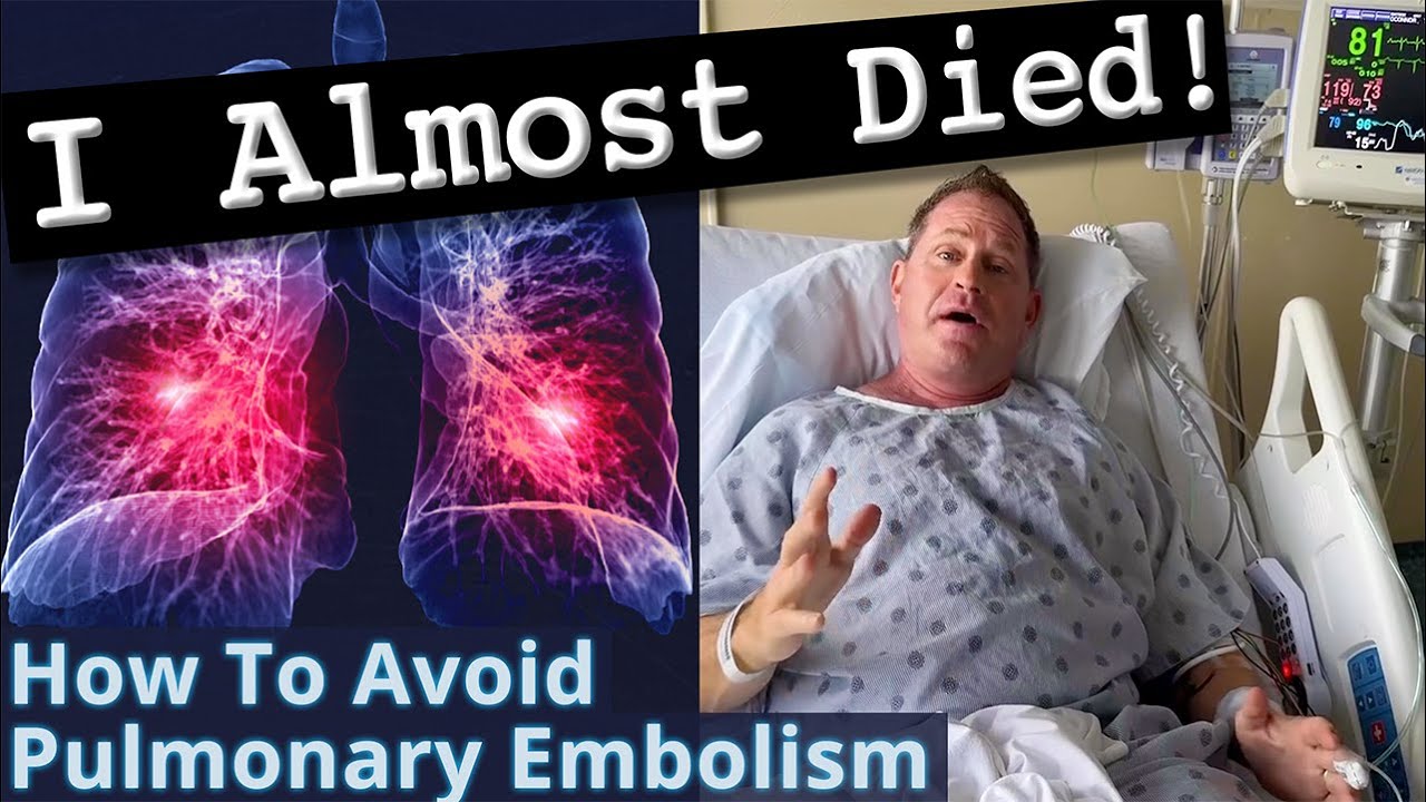 What Men on TRT & Steroids MUST DO Before Surgery to Avoid Pulmonary Embolism - Doctor's Experience!