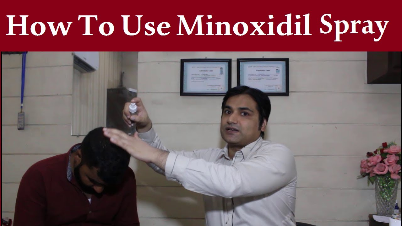How to use minoxidil spray | Benefits of minoxidil spray | uses of minoxidil spray |