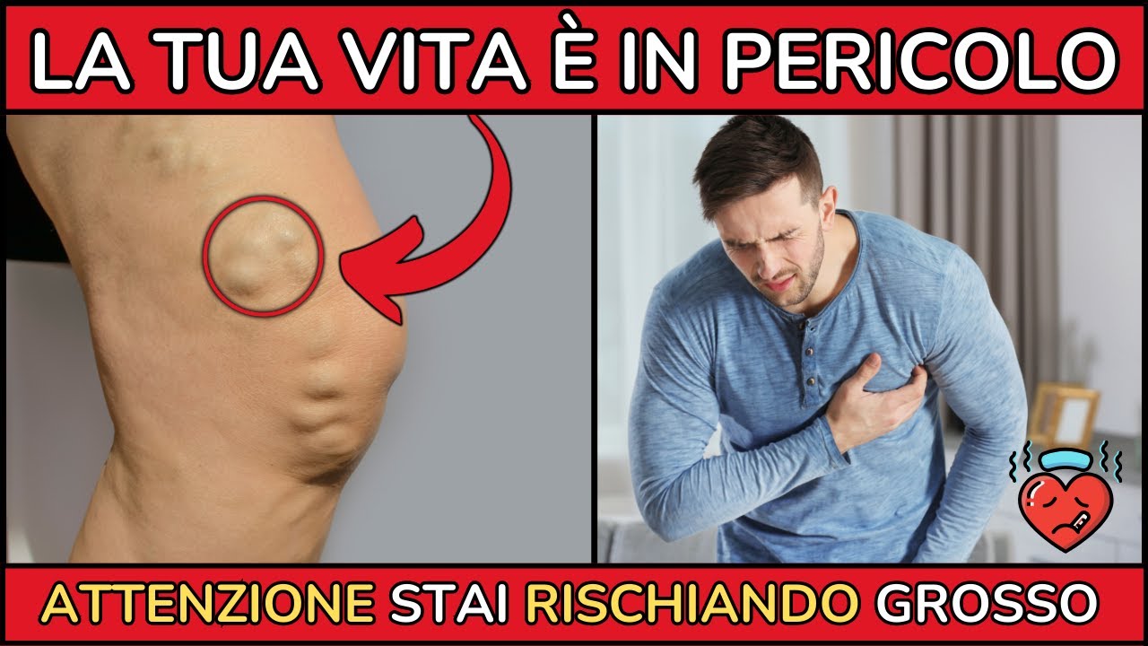 PROBLEMI CARDIACI: 9 SEGNALI che ti possono PORTARE alla MORTE!