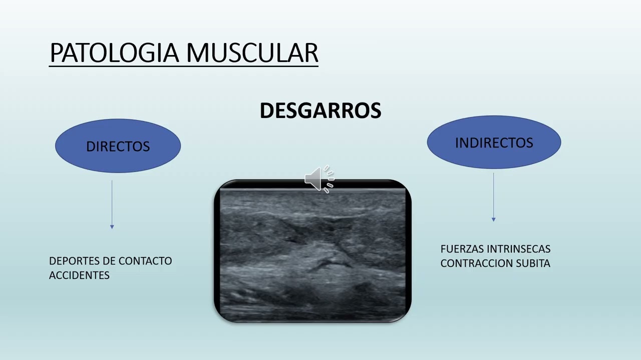 CLASE ECOGRAFIA MUSCULOESQUELETICA
