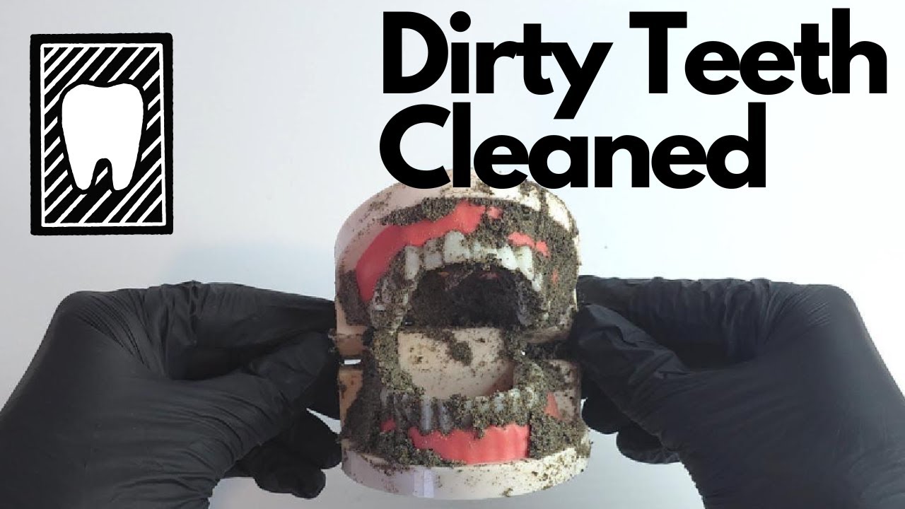 Teeth Brushing For A Dirty Teeth Miniature | ASMR Cleaning