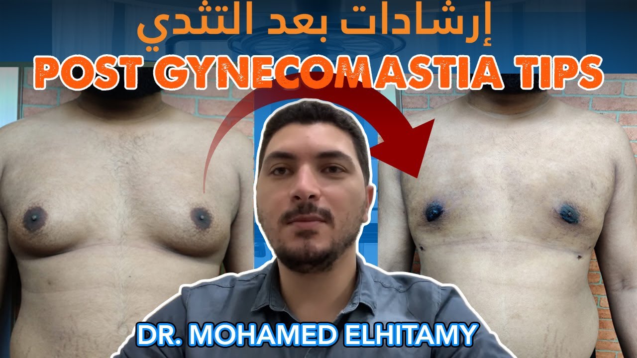 نصائح مهمة بعد عملية التثدي Essential Guidelines After Gynecomastia Surgery