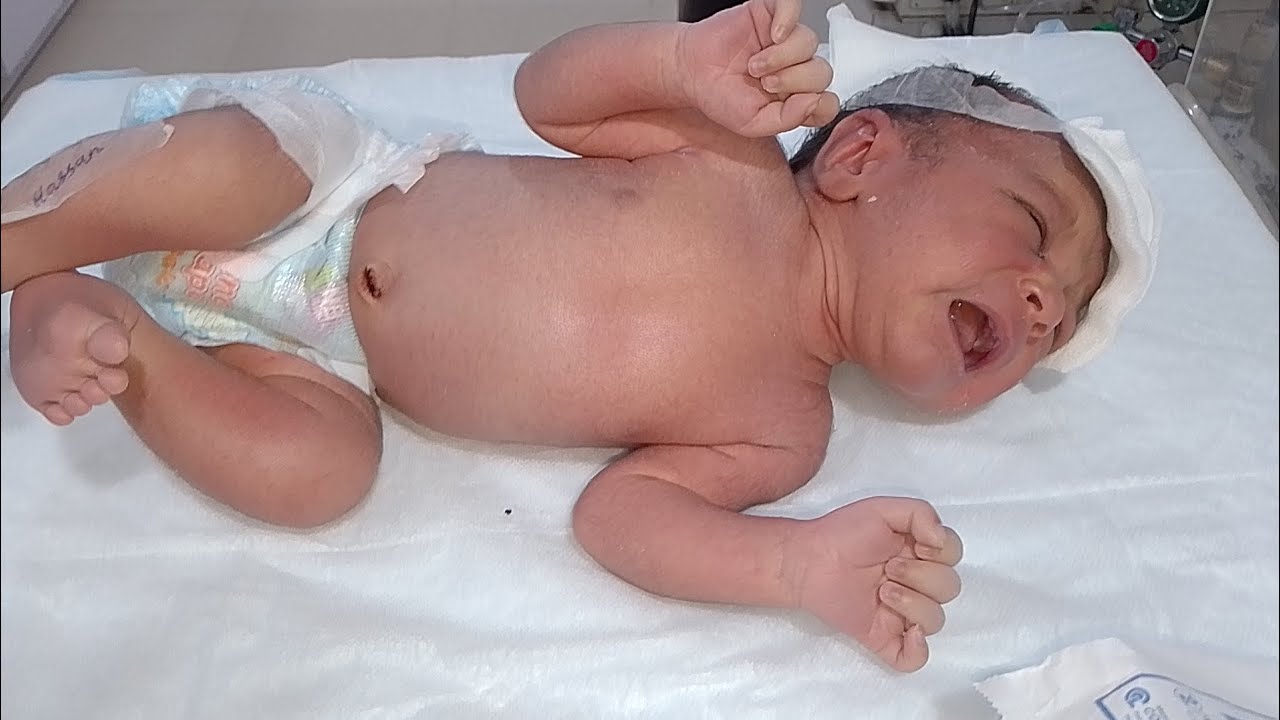 Newborn Baby with NNJ – First Trial Feeding, Warmer Care, and Physiotherapy in NICU