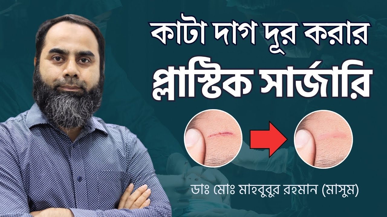 কাটা দাগ দূর করার  প্লাস্টিক সার্জারি | Dr. Md. Mahbubur Rahman (Masum)