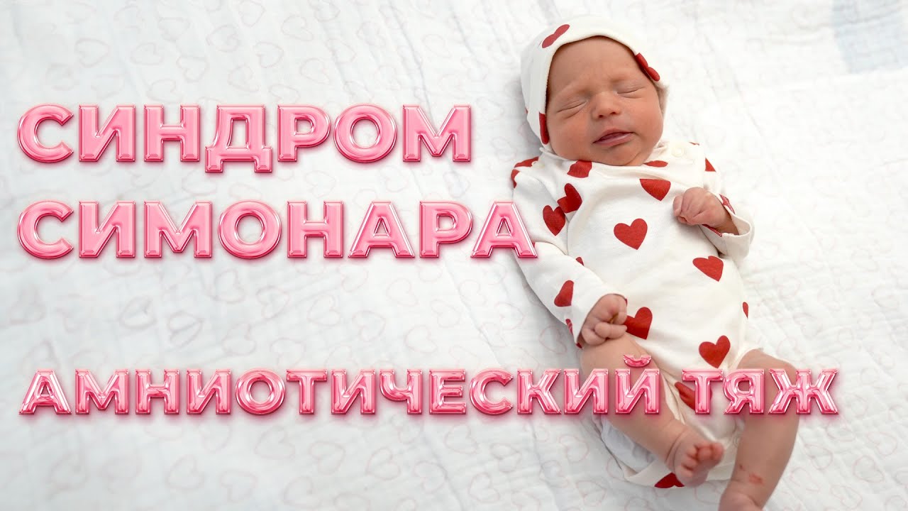 НАША ИСТОРИЯ! Я СМОГЛА И ТЫ СМОЖЕШЬ! Амниотический тяж или синдром Симонара