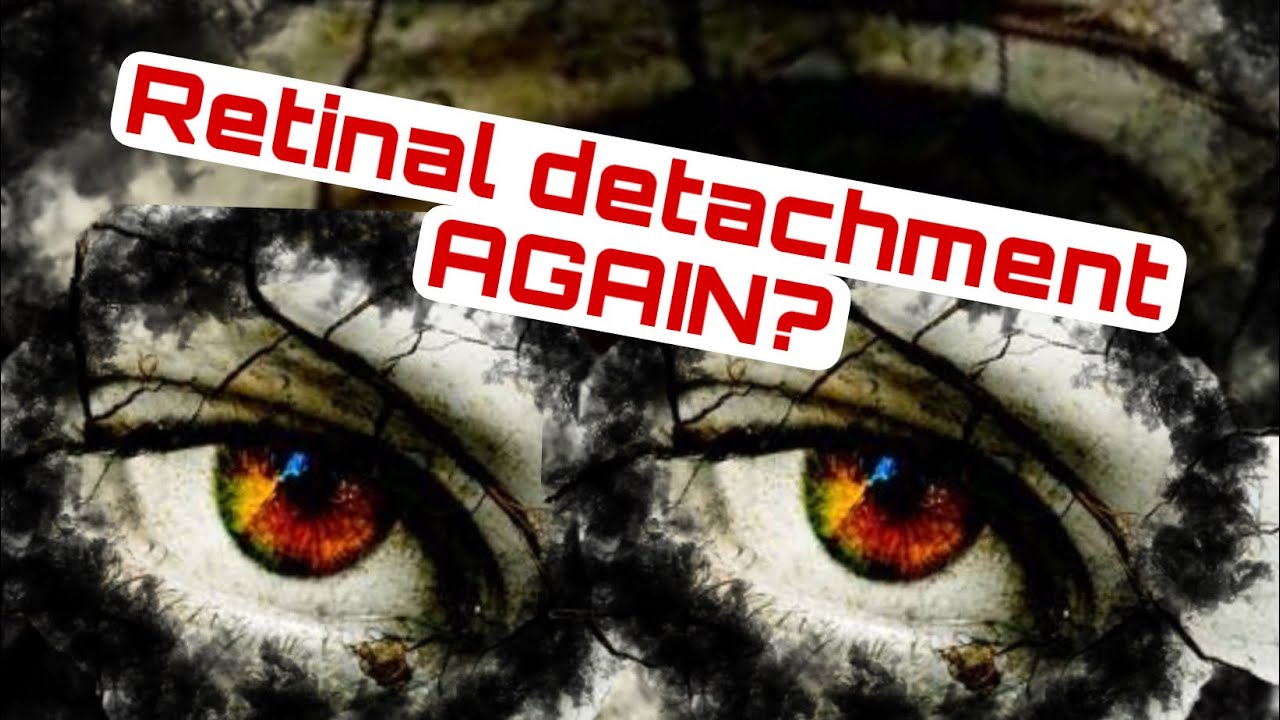 11: Can you get Retinal Detachment AGAIN / RETINAL DETACHMENT/#retinaldetachment