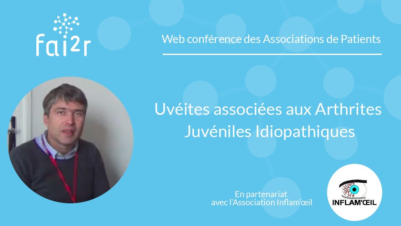 Uv&eacute;ites associ&eacute;es aux Arthrites Juv&eacute;niles Idiopathiques