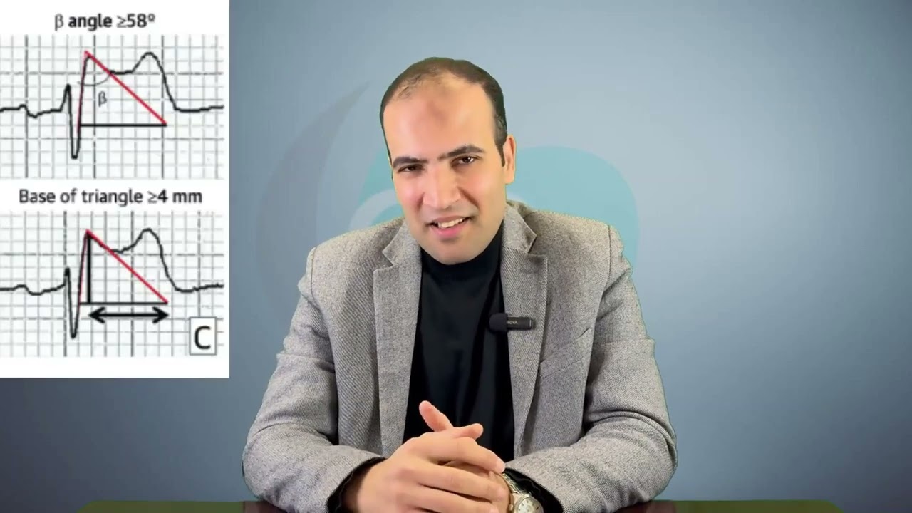 MSA Cardiology TV Episode 14 Brugada syndrome