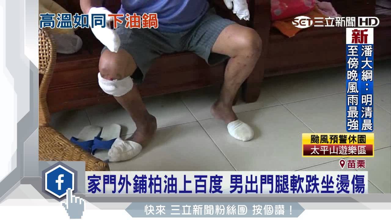 家門外鋪柏油上百度　男出門腿軟跌坐燙傷｜三立新聞台