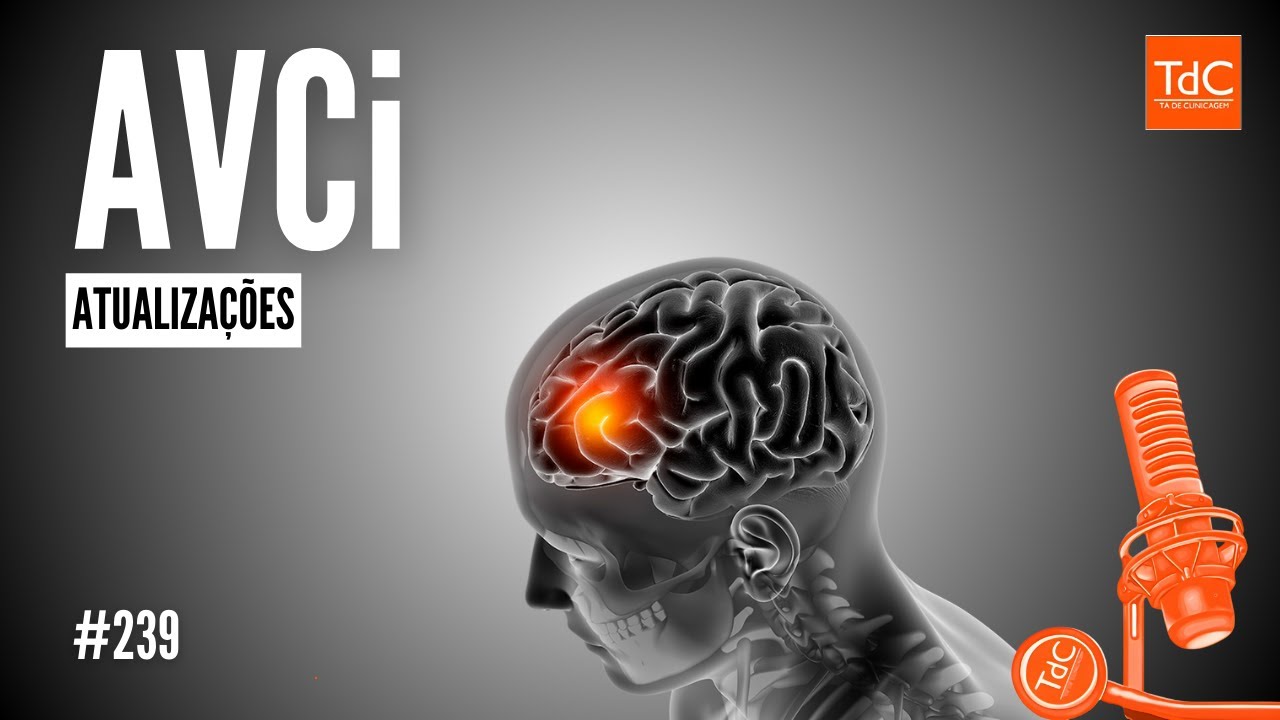AVC isquêmico [Atualizações] - Episódio 239