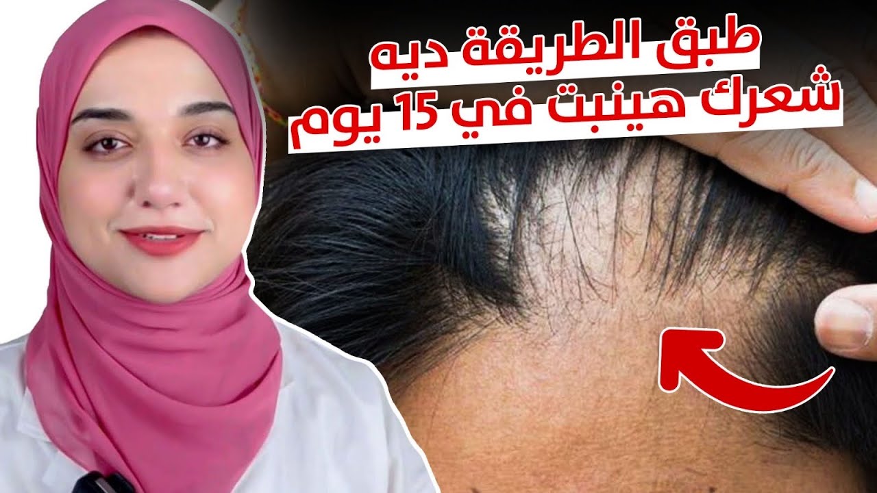 حل سريع لتراجع الشعر للخلف /انبات شعر جديد في اسبوعين