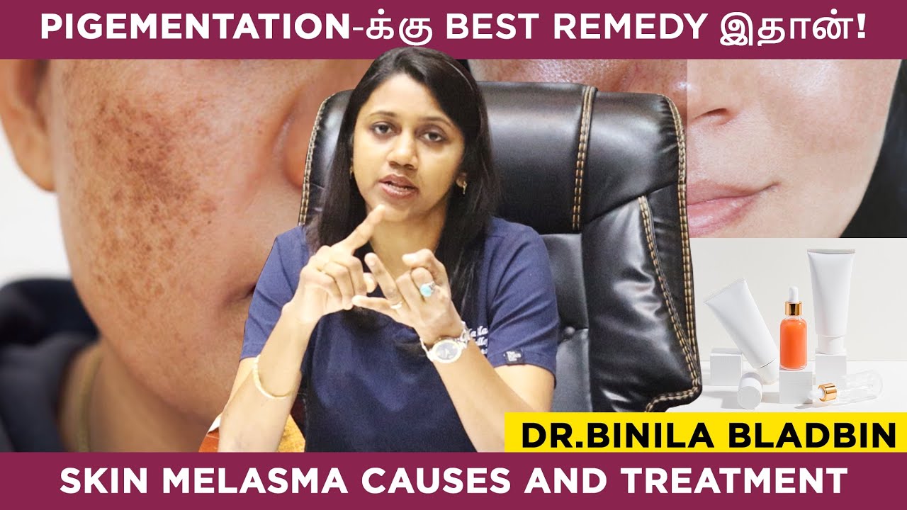 இந்த 3 விஷயம் பண்ணாலே Pigmentation வராது! - Dr Binila Bladbin Explains | Melasma Treatment