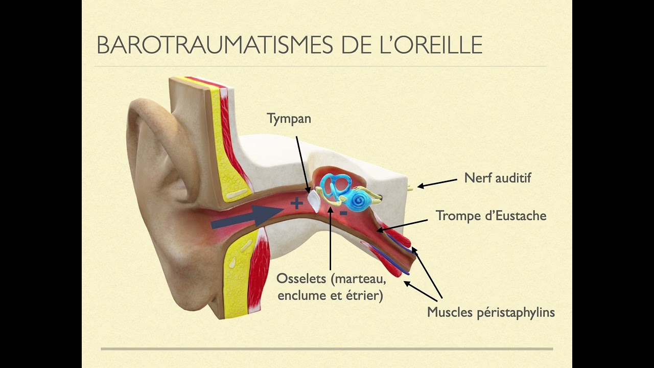 Barotraumatisme oreilles