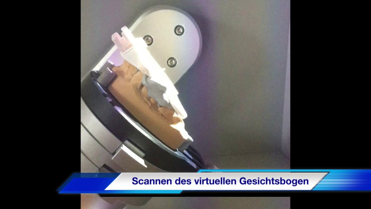5 Digitale Funktionsdiagnostik