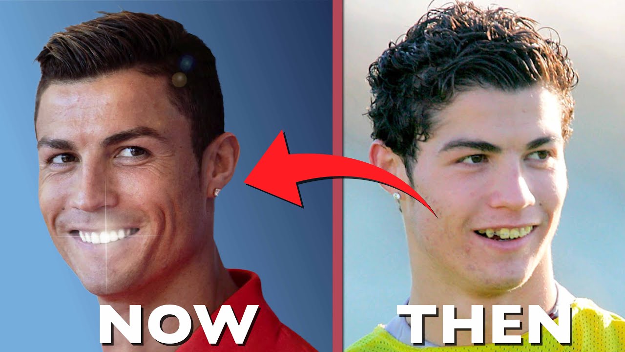 Top 10 Celebrity Dental Transformations That Will Leave You Speechless.