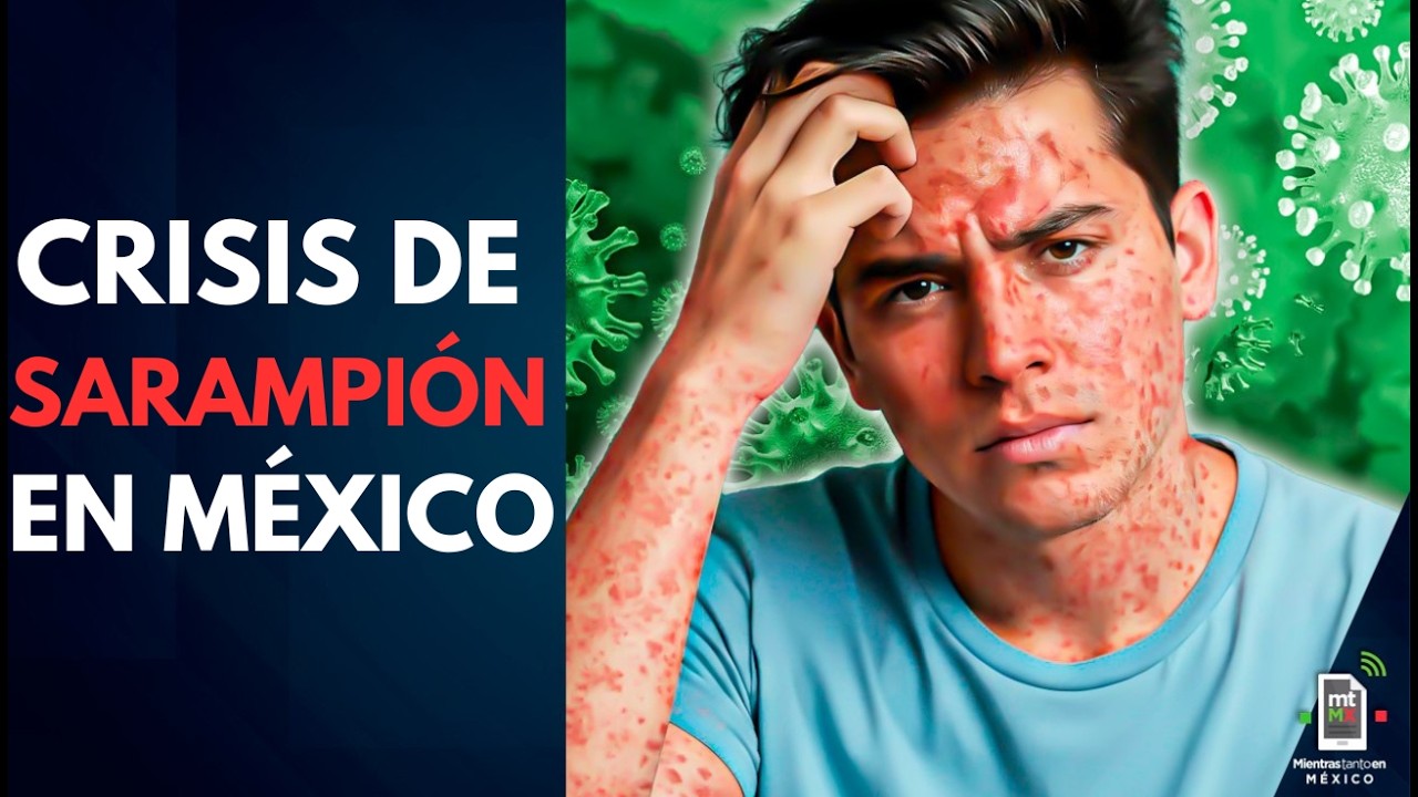 Crisis de SARAMPIÓN en México: Qué es, síntomas, riesgos y quiénes deben vacunarse | Mientras tanto