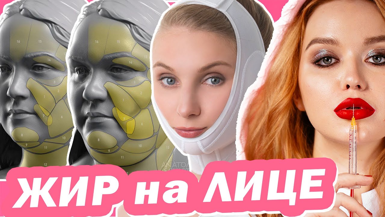 Эти СПОСОБЫ ИЗБАВЯТ от ПУХЛЫХ ЩЁК и ВТОРОГО ПОДБОРОДКА!