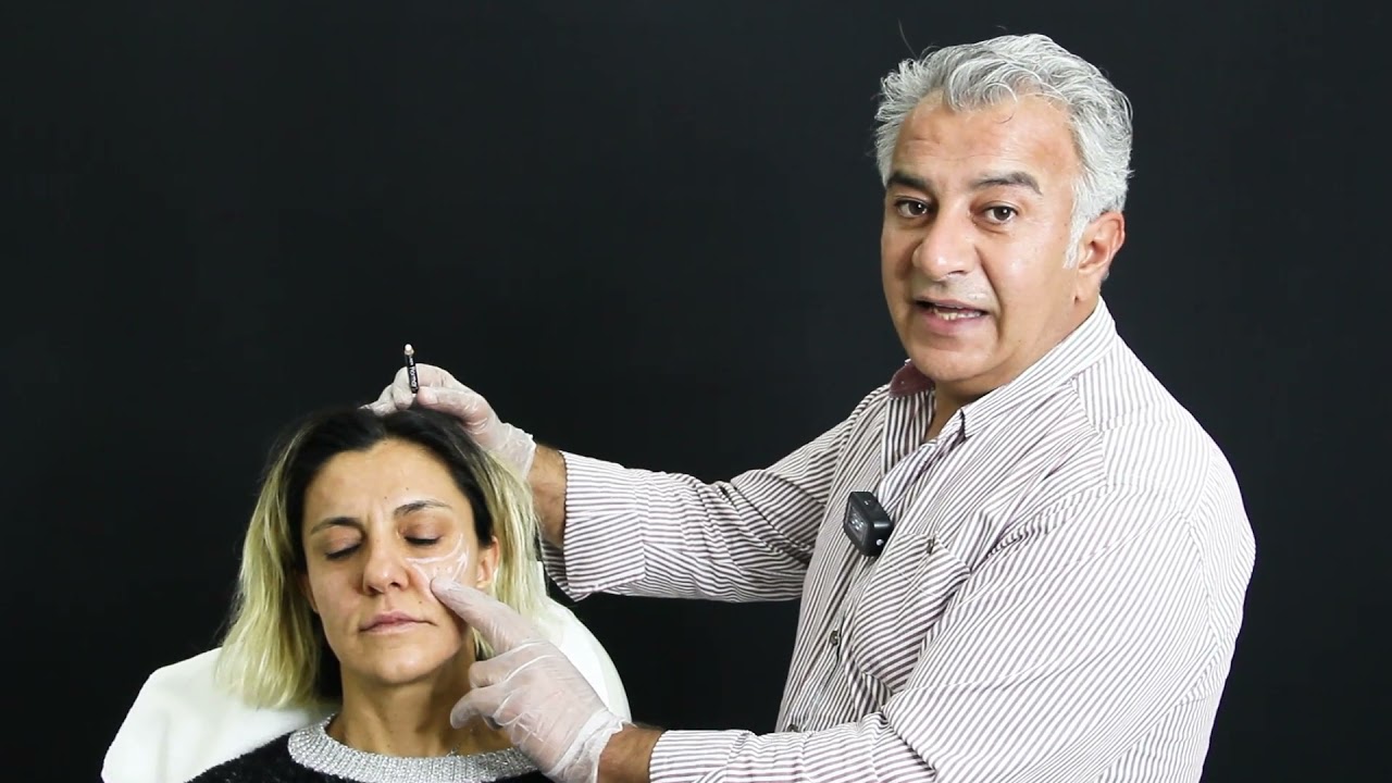 Zigomatik Dolgu | Dr. Servet Karayün