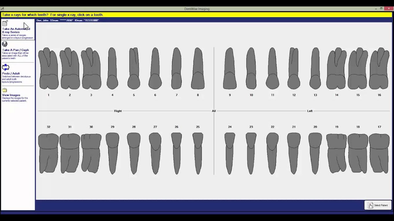 How to Take an X-ray | DentiMax Dental Imaging Tip