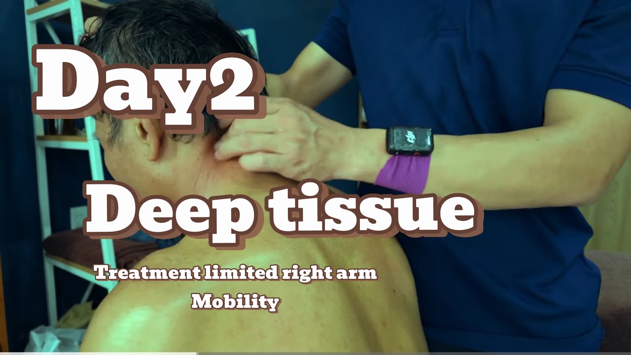 Deep Tissue Back Therapy ASMR | No Talking. DAY 2 TREATMENT LIMITTED MOBILITY IN RIGHT ARM.