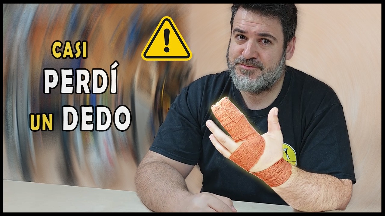 El día que casi PIERDO UN DEDO: Mi accidente en la sierra de mesa ⚠️