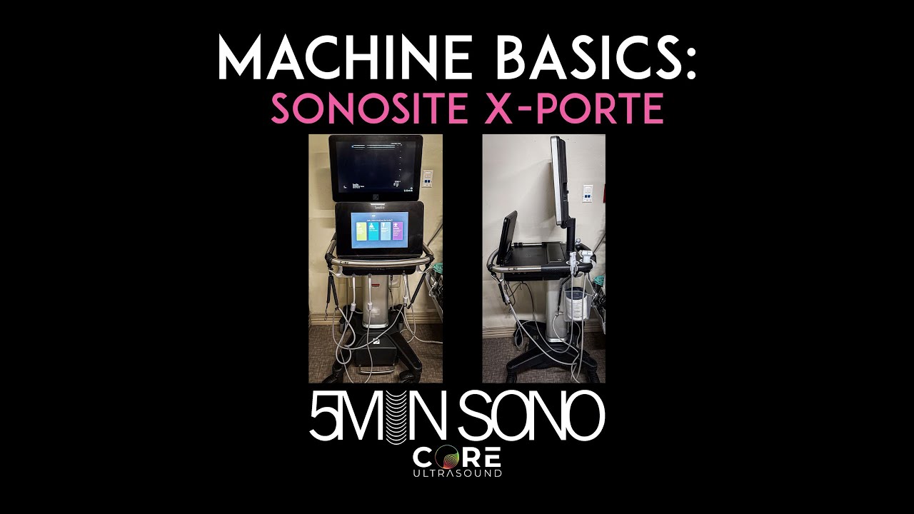 5-минутный Sono — основы работы с машиной Sonosite X-Porte