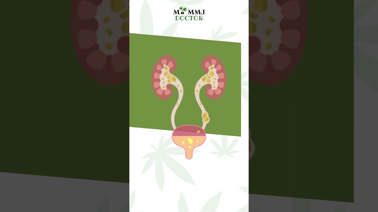 How Long Does WEED cannabis Stay in your Body #greendreams #weedwisdom #puffpuffpass #stonerlife