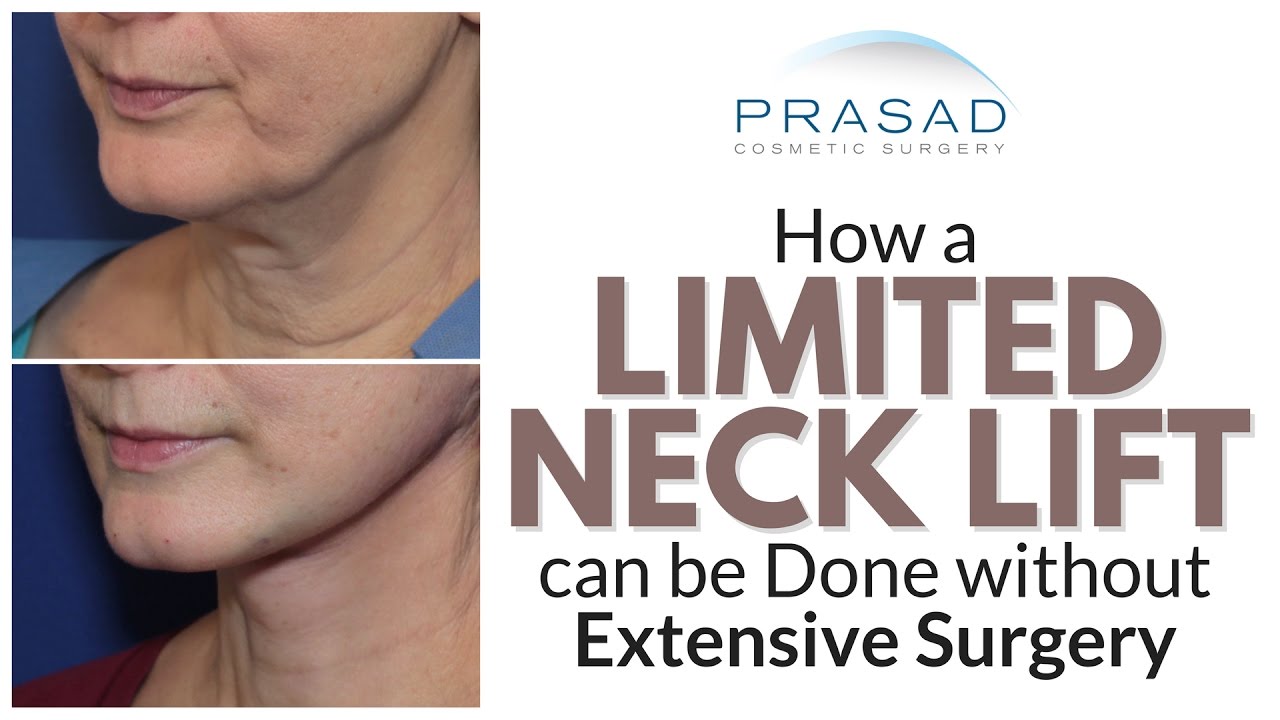 Why Best Neck Lift Results Require Surgery, but a Limited Lift can be Done Without Extensive Surgery