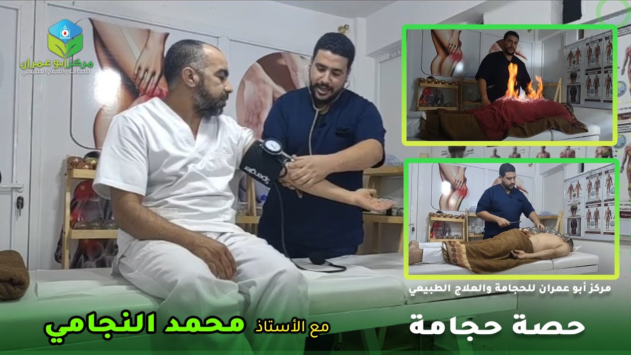الحجامة فن واتقان من مركز ابو عمران للحجامة والعلاج الطبيعي بمكناس #الحجامة_بمكناس