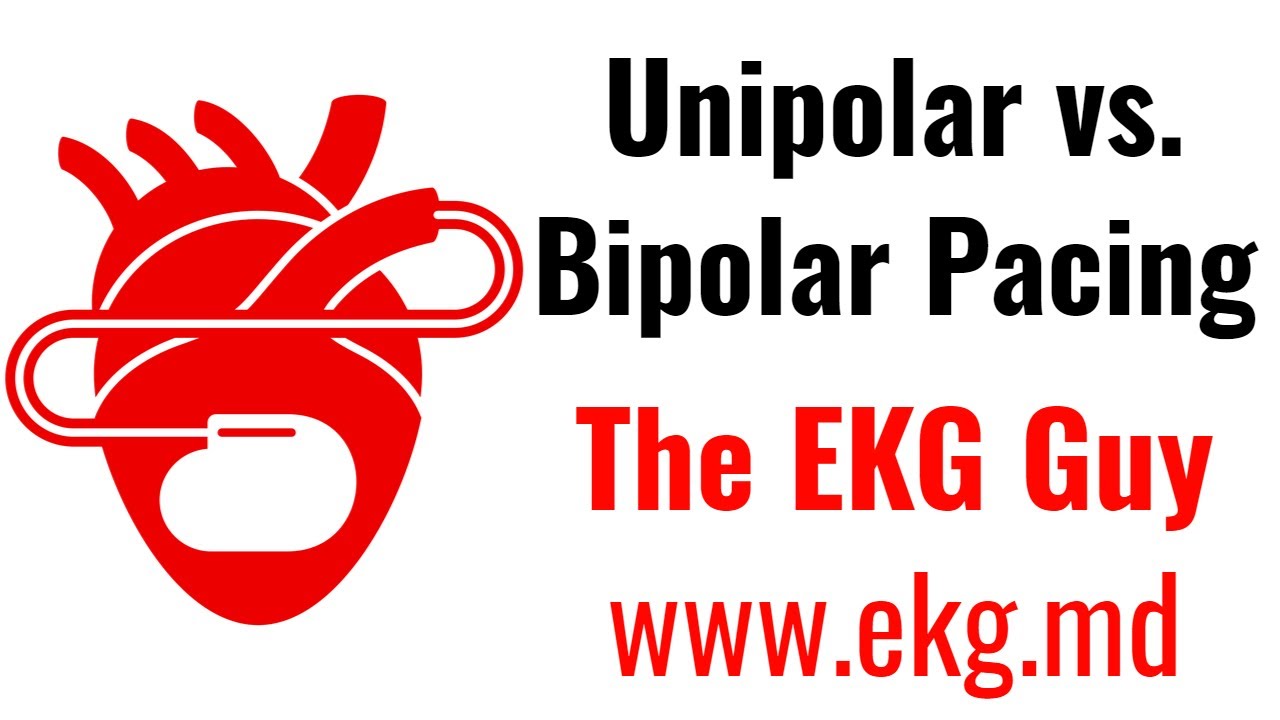 Unipolar vs. Bipolar Pacing - EKG / ECG Course 123.0 | The EKG Guy - www.ekg.md
